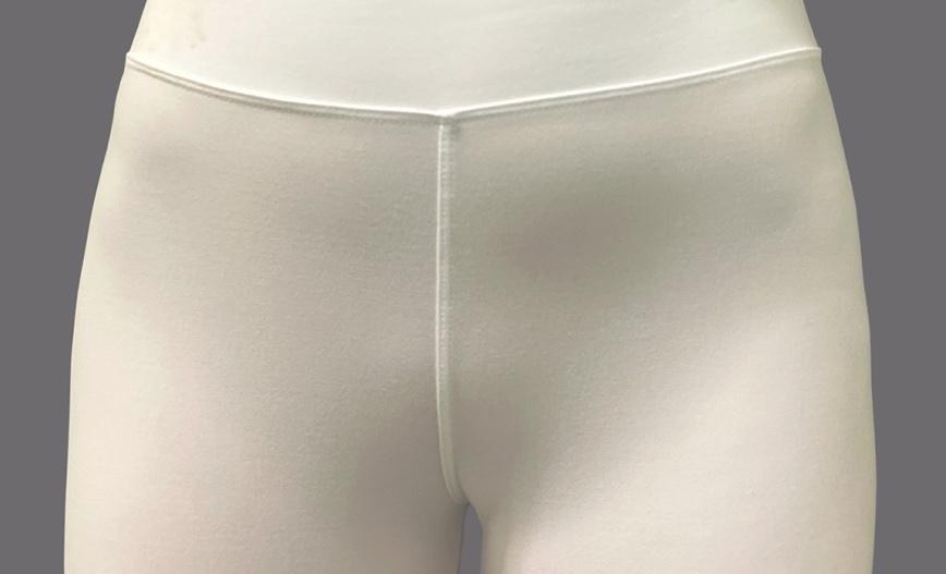 Day 1 after AlloClae hip dip treatment