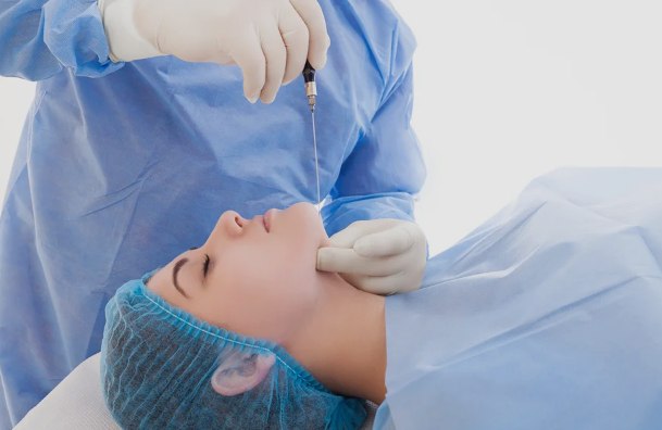 Treatment-area markings before a SmartLipo chin and neck procedure